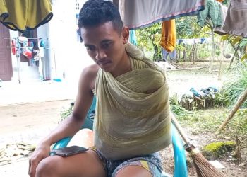 Korban Kecelakaan Proyek Jalan Alami Patah Tangan Butuh Bantuan