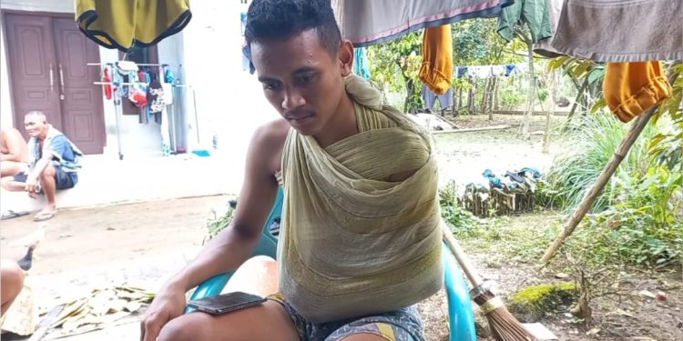 Korban Kecelakaan Proyek Jalan Alami Patah Tangan Butuh Bantuan