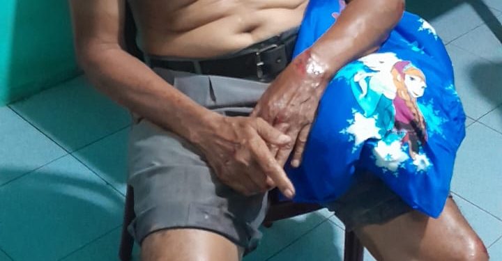 Loper Koran di Medan Nyaris Tewas Diserang Begal